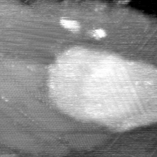 021912CP