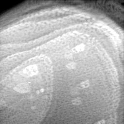 09012020AD