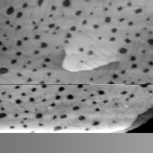 09151100AN